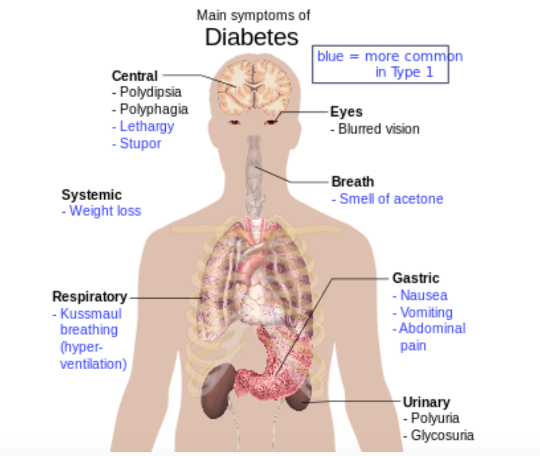 stem-cell-treatment-Diabetes-mellitus