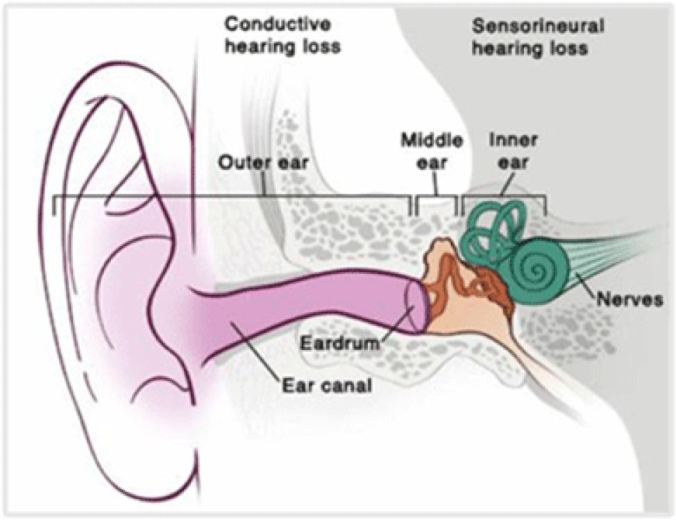 stemulus-stem-cell-treatment-Sensorineural-hearing-loss