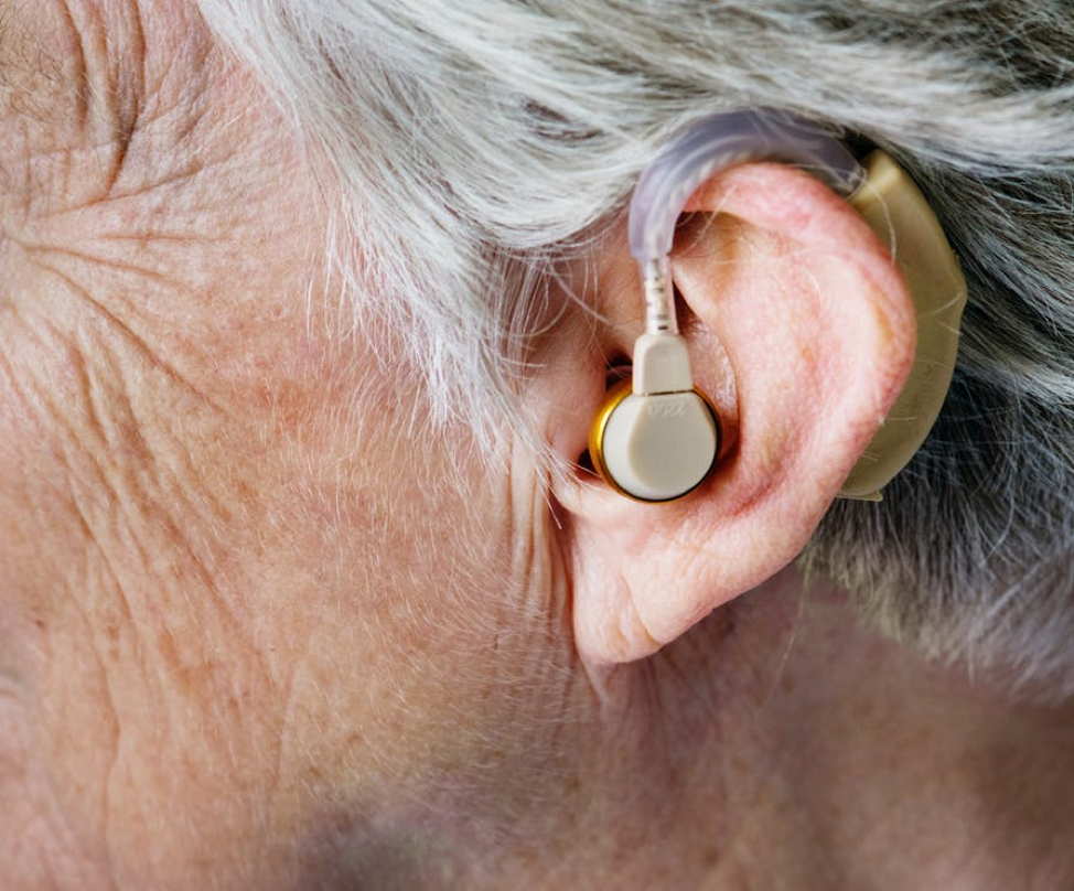 stem-cell-treatment-Sensorineural-hearing-loss