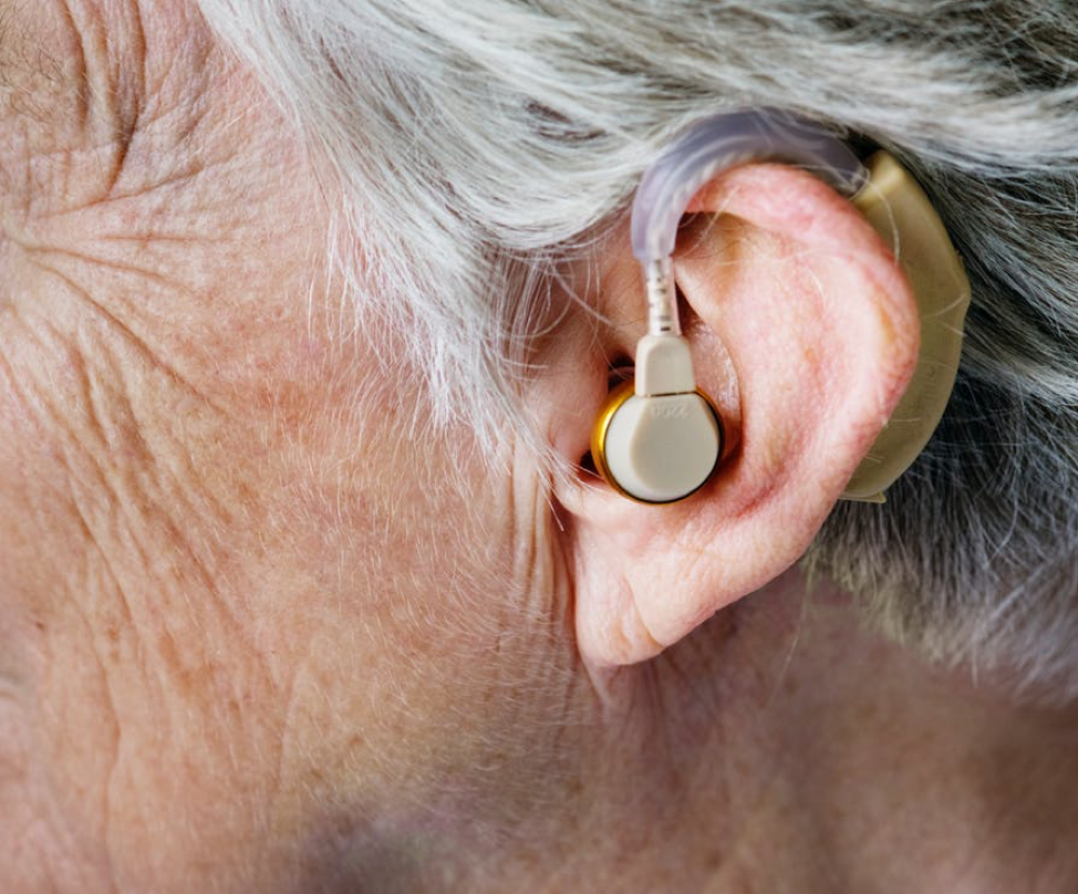 Another Name For Sensorineural Hearing Loss